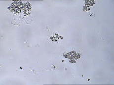 Samenzellen-Funktions-Test-Ausrüstung MRZ IgA Test Kit IgA Antibody Coating Spermatozoa MRZ