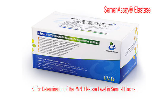 40T/Kit Spermien-DNA-Fragmentierungs-Kit mit SCD-Methode und CE-Zulassung für genaue DNA-Fragmentierungsprüfung