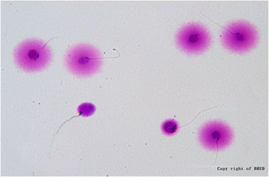 BRED Spermien-DNA-Fragmentierungstest 24 Monate Haltbarkeit