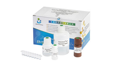 Männliches Test-Kit For Determination Acid Phosphatase-Niveau der Ergiebigkeits-BRED-009 im fruchtbaren Plasma