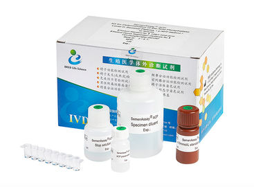 Einfacher Gebrauchs-männliche Ergiebigkeits-Test-Ausrüstung/männliche Unfruchtbarkeits-Diagnosen-Ausrüstung für fruchtbares Plasma