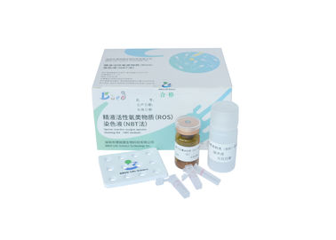 Methode der erwachsene Mannes-ROS Assay Kit Sperm Reactive-Sauerstoff-Spezies-Proben-Ausrüstungs-NBT