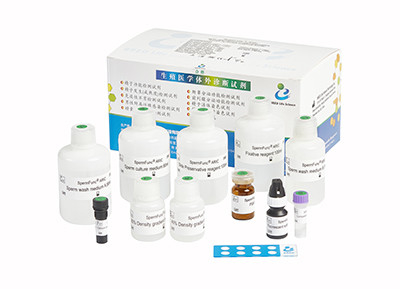 Verursachte Samenzellen Acrosome-Reaktions-Reagens-Kit Accuracy Male Fertility Test-Ausrüstung